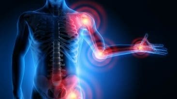 Musculoskeletal System and Oxidative Stress EL Paso Tx
